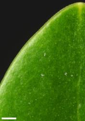 Veronica saxicola. Leaf margin, showing minute hairs. Scale = 1 mm.
 Image: P.J. Garnock-Jones © P.J. Garnock-Jones CC-BY-NC 3.0 NZ